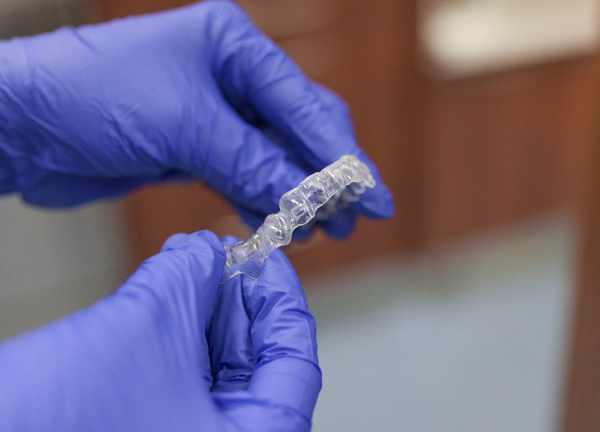 Clear Aligners: Fact or Fiction